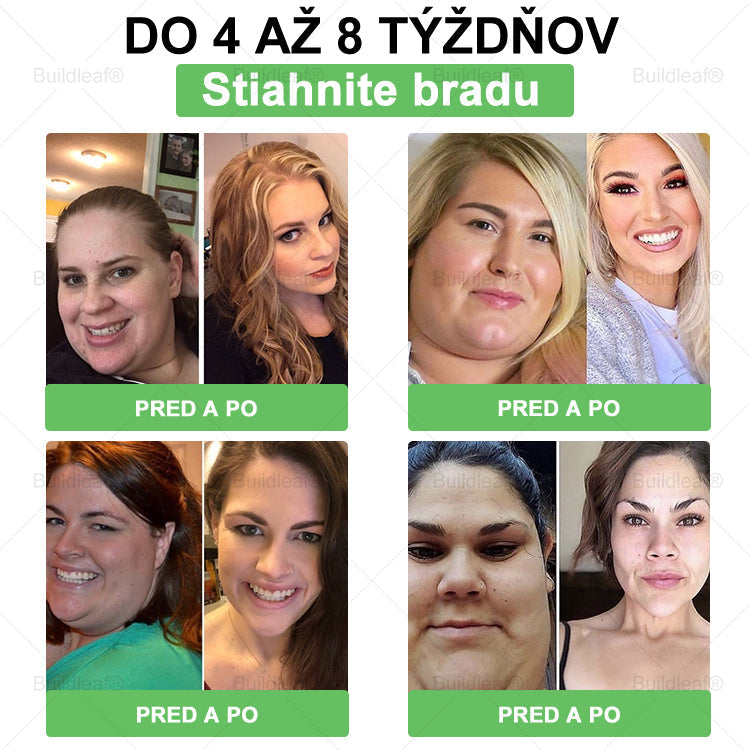 🎁 Zostalo už len 5 balení! Teraz dávame ďalších 50% zľavu! Buď fit a zdravý. Ak nevyužiješ túto príležitosť teraz, ďalšia bude až budúci rok!