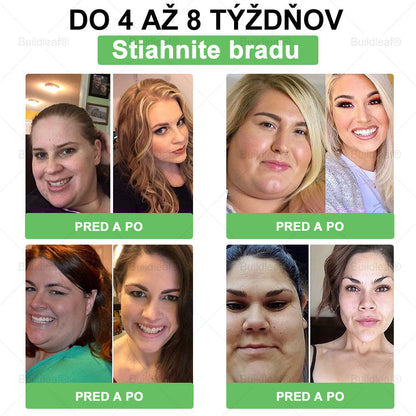 🎁 Zostalo už len 5 balení! Teraz dávame ďalších 50% zľavu! Buď fit a zdravý. Ak nevyužiješ túto príležitosť teraz, ďalšia bude až budúci rok!