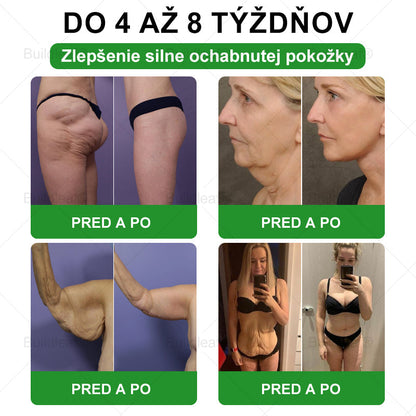 🎁 Zostalo už len 5 balení! Teraz dávame ďalších 50% zľavu! Buď fit a zdravý. Ak nevyužiješ túto príležitosť teraz, ďalšia bude až budúci rok!