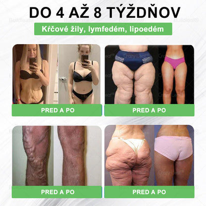 🎁 Zostalo už len 5 balení! Teraz dávame ďalších 50% zľavu! Buď fit a zdravý. Ak nevyužiješ túto príležitosť teraz, ďalšia bude až budúci rok!